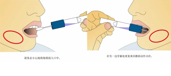 口腔拭子采样方法