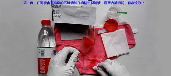 1595575456115320.jpg 精斑鉴定.jpg